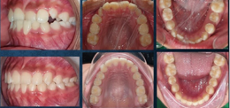 UP Orthodontists Provide Excellent Results!